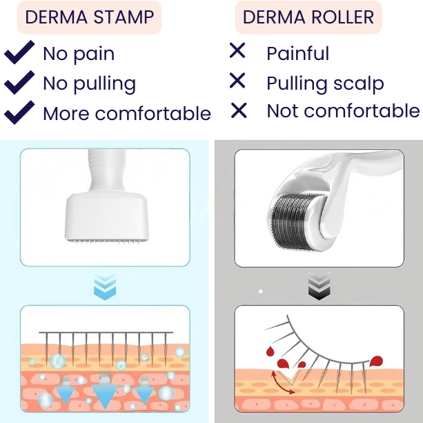 BloomyLUX™ Derma Stamp- Hair Skin Stamp- Adjustable 140 Tip Stainless Steel For Hair Loss And Wrinkles, Acne Scars. Anti Aging