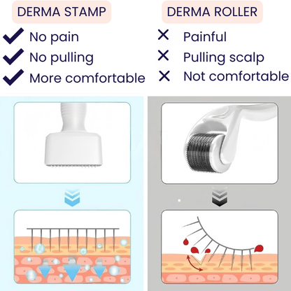 BloomyLUX™ Derma Stamp- Hair Skin Stamp- Adjustable 140 Tip Stainless Steel For Hair Loss And Wrinkles, Acne Scars. Anti Aging